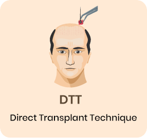 Direct TRansplant Technique